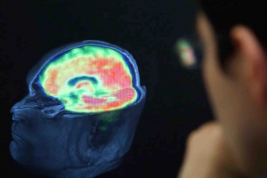 Revierten el Parkinson en ratones reemplazando neuronas