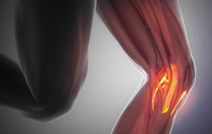 Roturas ligamentarias, más común de lo habitual.